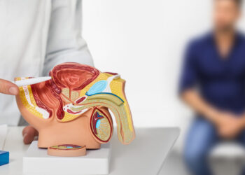 Tumore prostata, radioterapia si conferma strategia più efficace contro le recidive