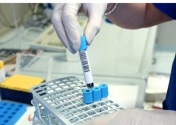 Da Verona 70 modelli di tumore per la ricerca oncologica internazionale