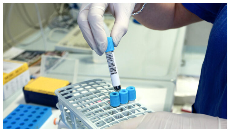 Da Verona 70 modelli di tumore per la ricerca oncologica internazionale